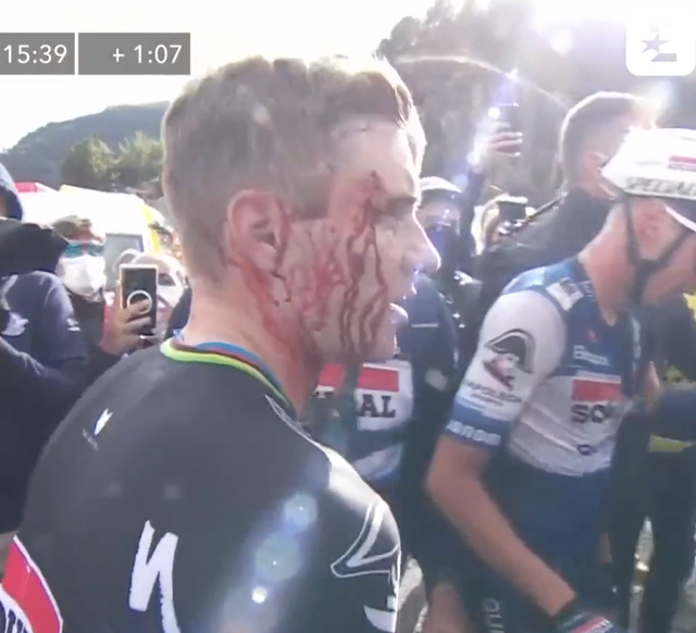 <p>Remco Evenepoel’s face is bloodied following the incident</p>